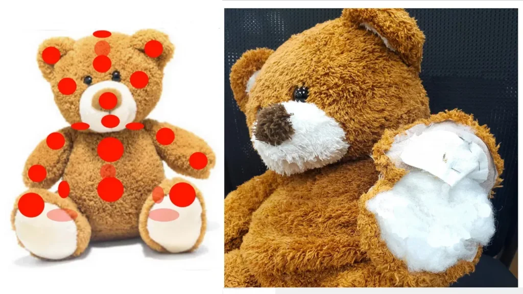 Brown teddy bear with repair spots and stuffed arm open for fixing.